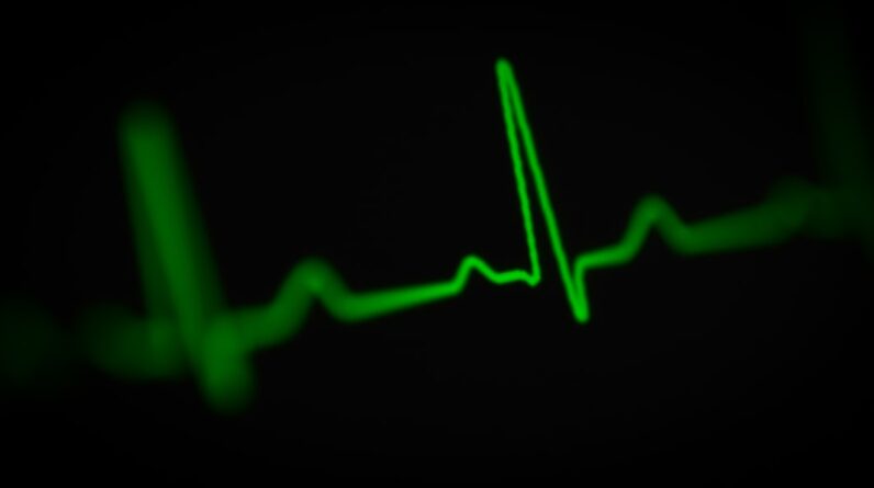 Photo Heart rate monitor