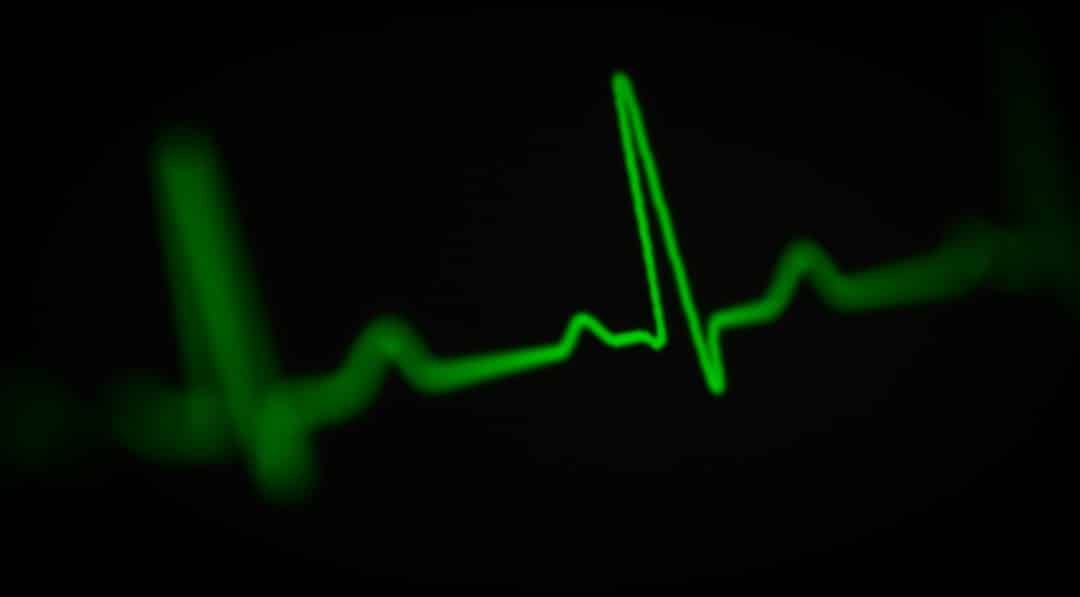 Photo Heart rate monitor